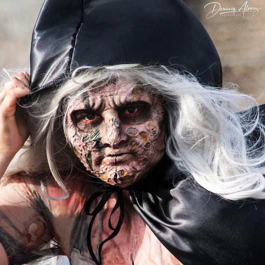 Necrosis